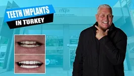 Teeth-implants-missing-broken-in-Turkey