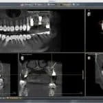 Myra Dental Centre Turkey - 3d Sirona Xray Tomography