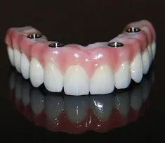 Myra Dental Centre Turkey - Cosmetic Dentures 