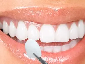 Myra Dental Centre Turkey - Dental Crowns Premium Selections