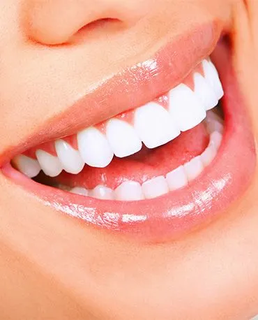 Myra Dental Centre Turkey - Dental Crowns Premium Selections