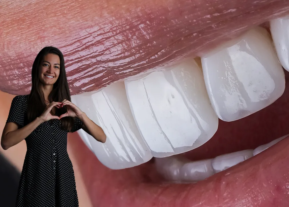 What is the Cost of Dental Crowns in Turkey?