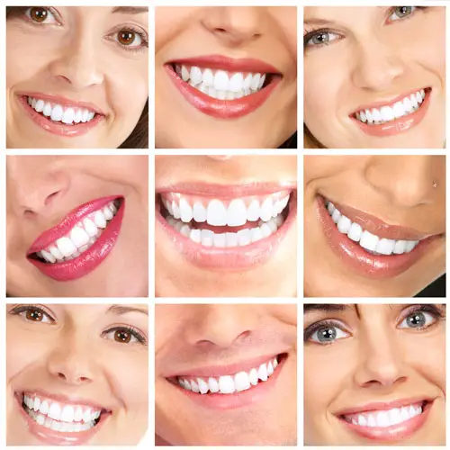 Myra Dental Centre Turkey - Digital Smile Makeover