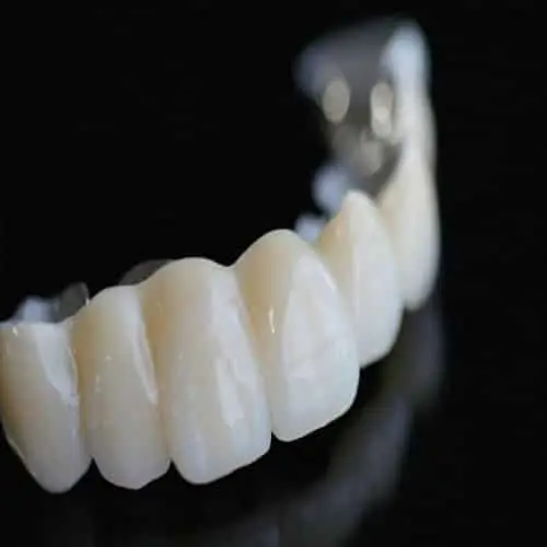 Myra Dental Centre Turkey -  Zirconium Dental Crowns Veneers Turkey